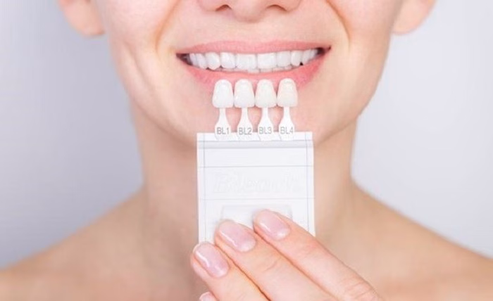 A Comprehensive Guide to Preparing for Your Teeth Whitening Appointment Picture1 1