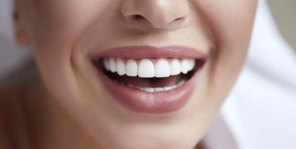 Cosmetic Dentistry: 8 Reasons You Need to Book a Smile Makeover 2323324