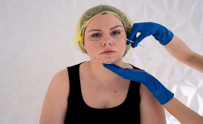 What Is the Difference Between Botox and Fillers? Screenshot 4