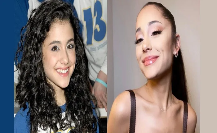 Ariana Grande’s Subtle Transformation: Her Plastic Surgery Journey from Teen Star to Chart-Topping Icon Ariana Grandes Subtle Transformation